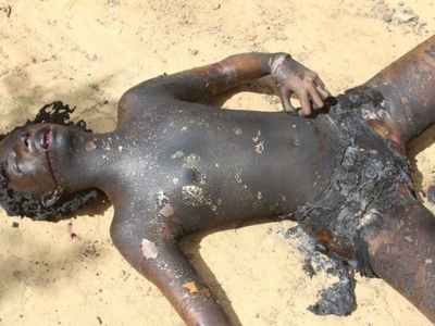 Prostitute Gets Beaten Unconscious and Burned Alive