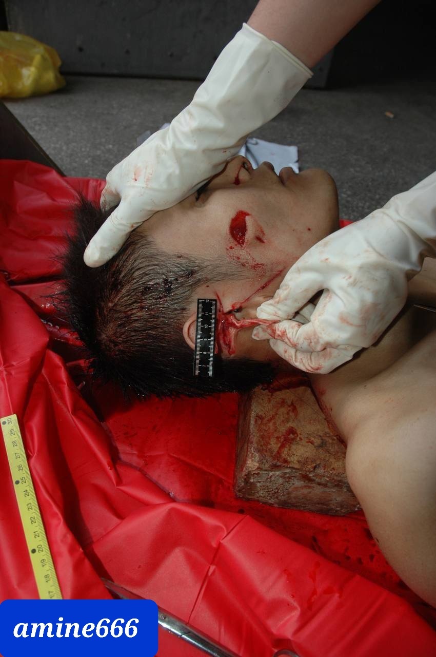 Theync autopsy fuck Autopsy of young Chinese man stabbed to death | theYNC