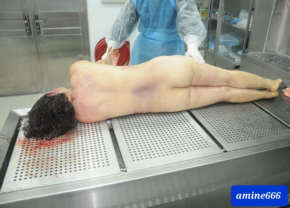 AMINE666  NAKEDdead girl naked amine666 Examination a nude dead corps of ugly Chinese women | theYNC