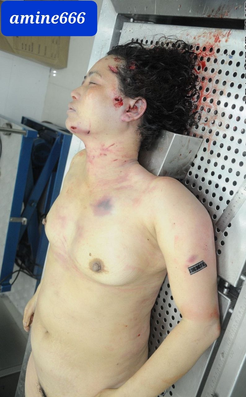 Dead chinese girl examined theync