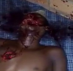 Man Disfigured with 12 Gauge Shots To his Chest and Face While he Slept