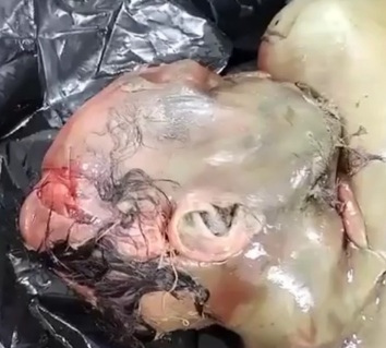 rotten naked dead girl corpse nude Examination a nude dead corps of ugly Chinese women | theYNC