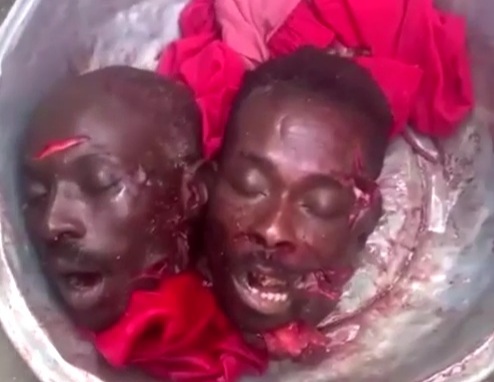 [NORMAL DAY IN HAITI]Two decapitated heads of gang member in bucket 