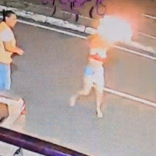 Woman Pours Gasoline on Her Boyfriend & Sets Him on Fire