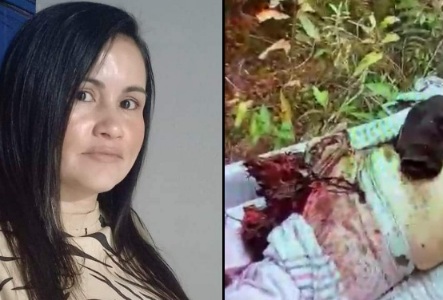 Colombian Woman Died after Stepping on Old Mine