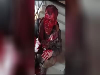 She turned man's face into bloody mess due to suspicions of treason