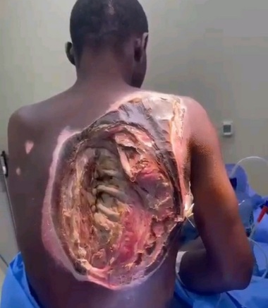 WTF: Dude Became See Through (Hows he Alive?)