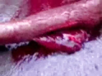 Bathed in Blood...Man Murdered for Revenge has lost almost his Entire Blood Supply