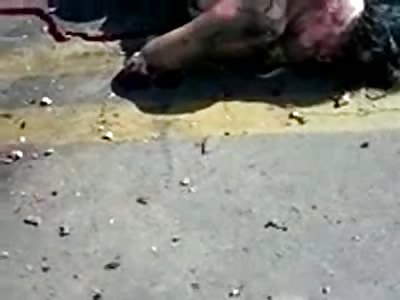 Woman a Mangled Mess in the Street with her Partner in Desperate Pain