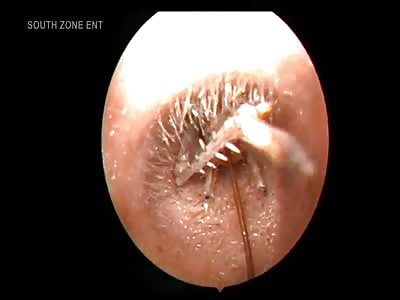 insect in the ear...